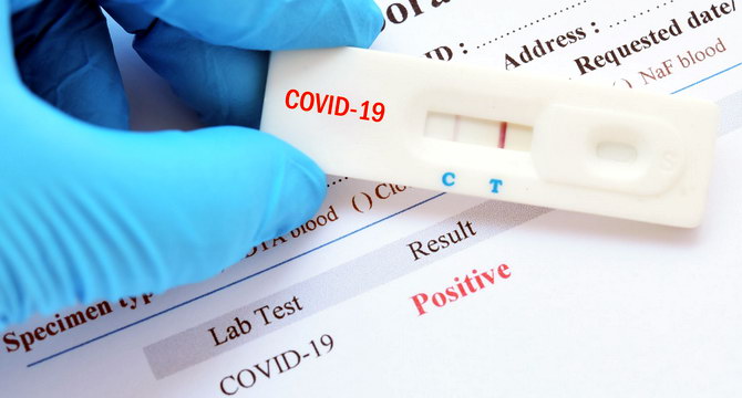 експрес-тест на коронавірус
